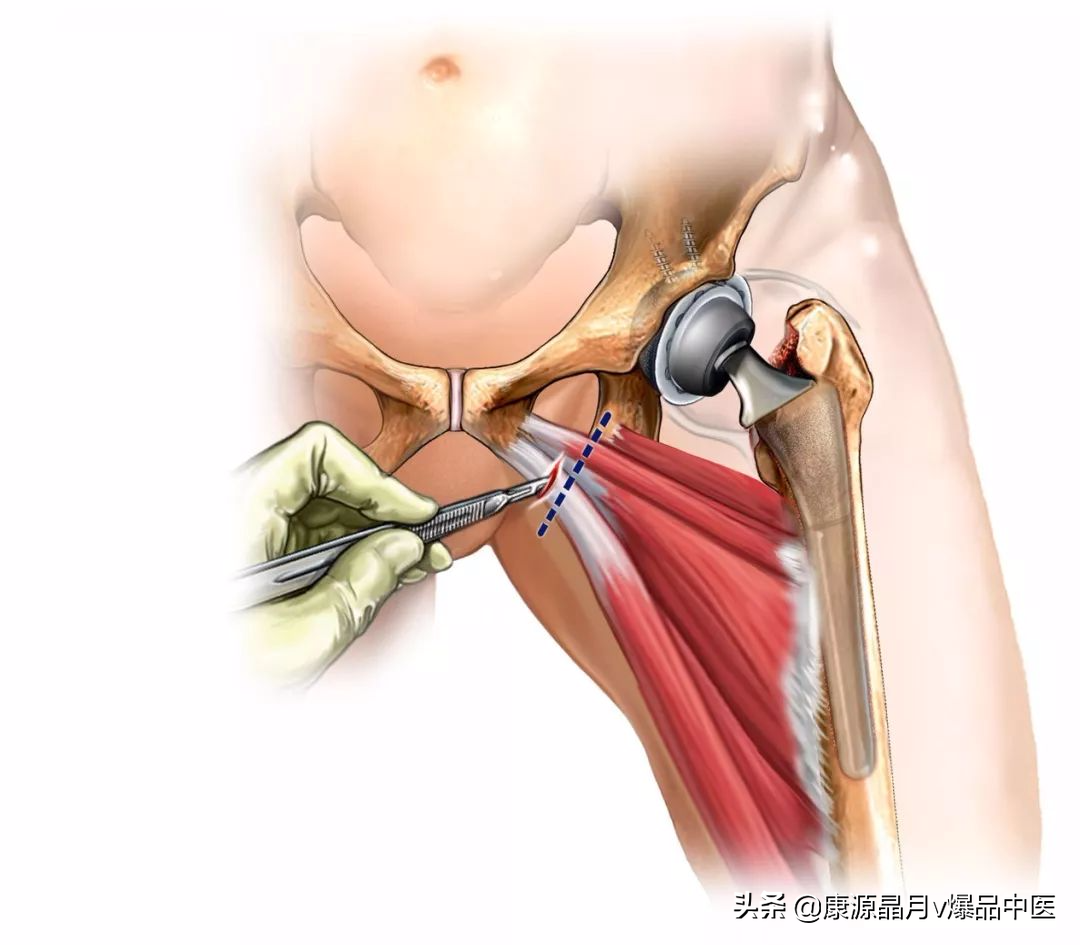 大腿疼痛的各种诊断