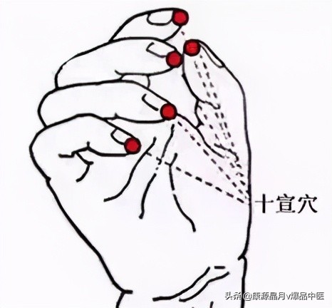 最齐全的“穴位拍打操”，治疗百病！自己就是最好的医生