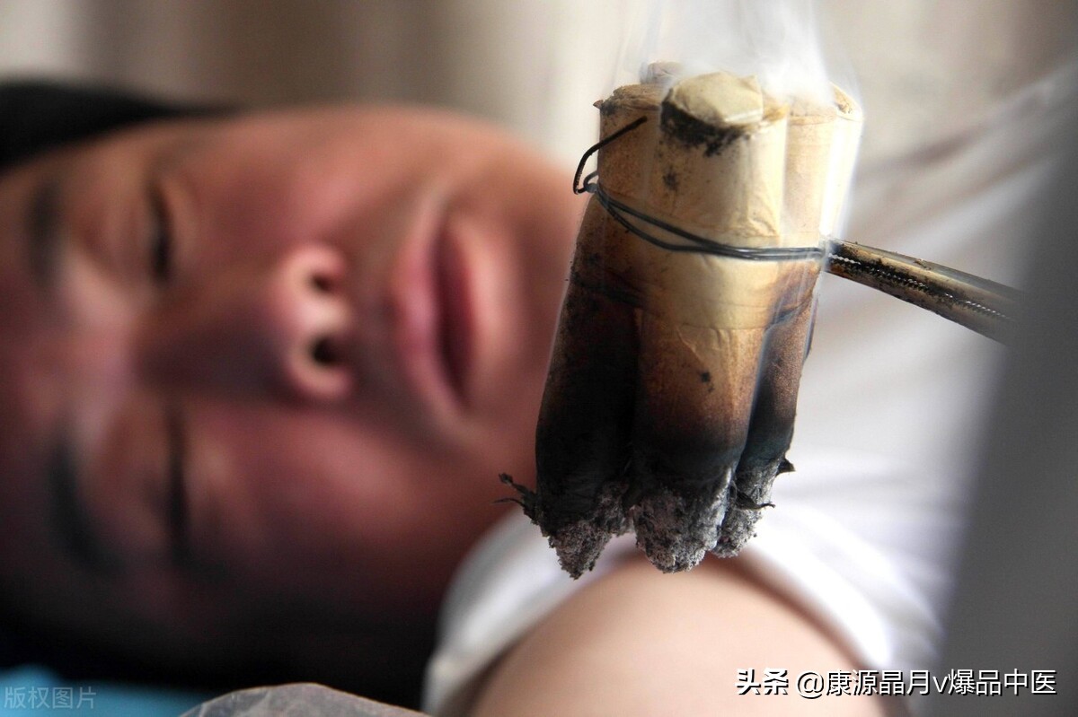 灸法的选穴要点
