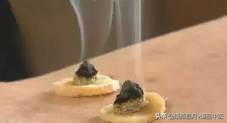 灸法的选穴要点