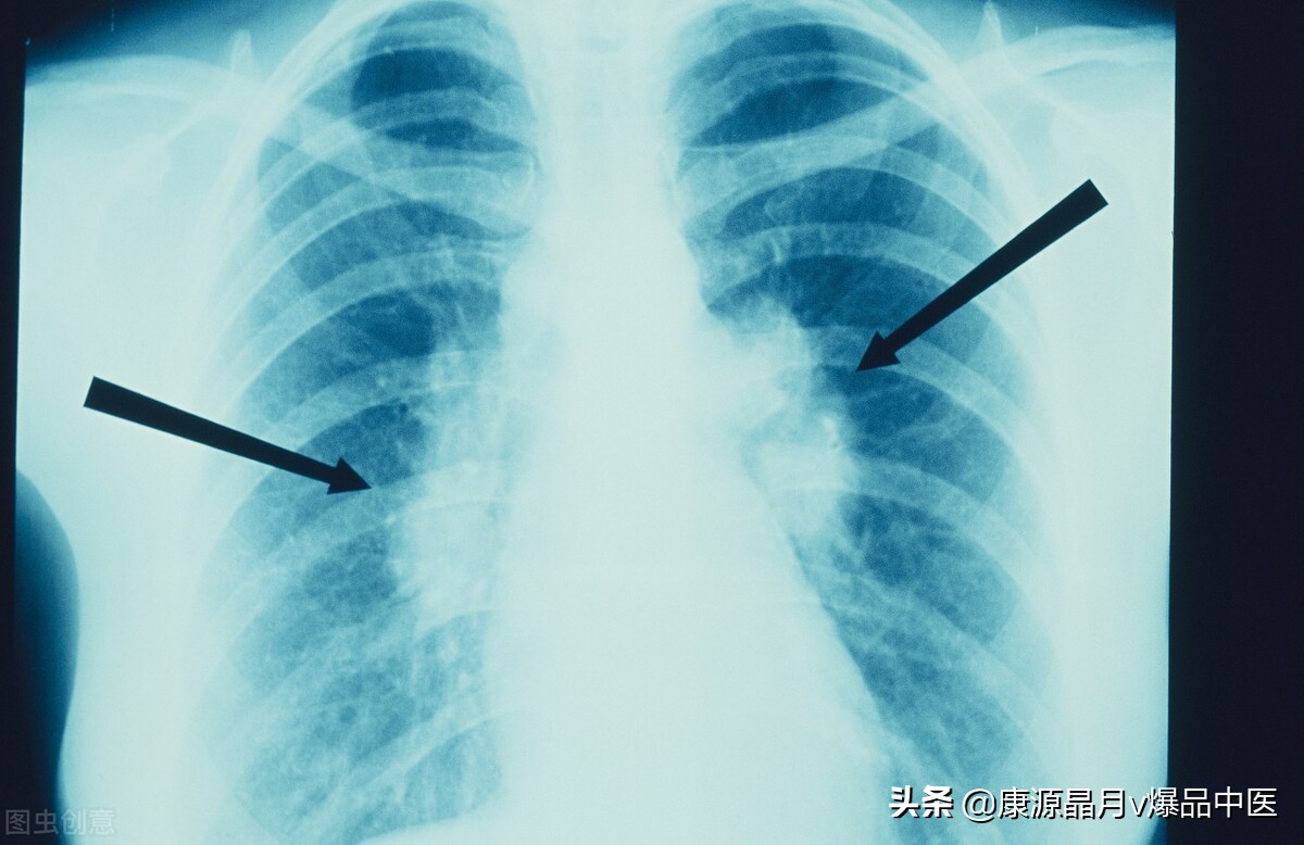 一穴调一病！36种常见病手到病除（收藏）