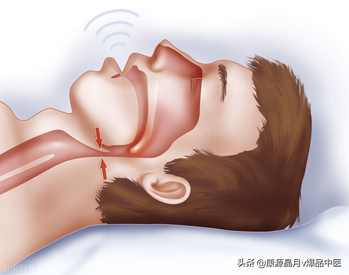 30种常见急症的紧急首选止疼穴位