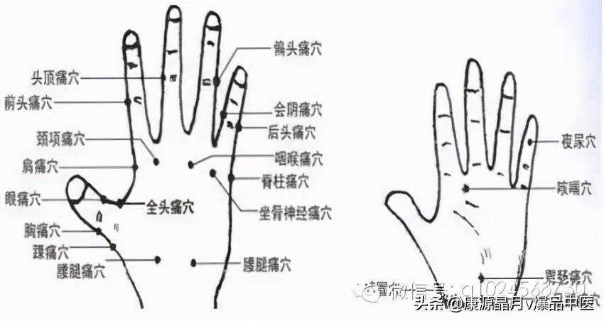 30种常见急症的紧急首选止疼穴位