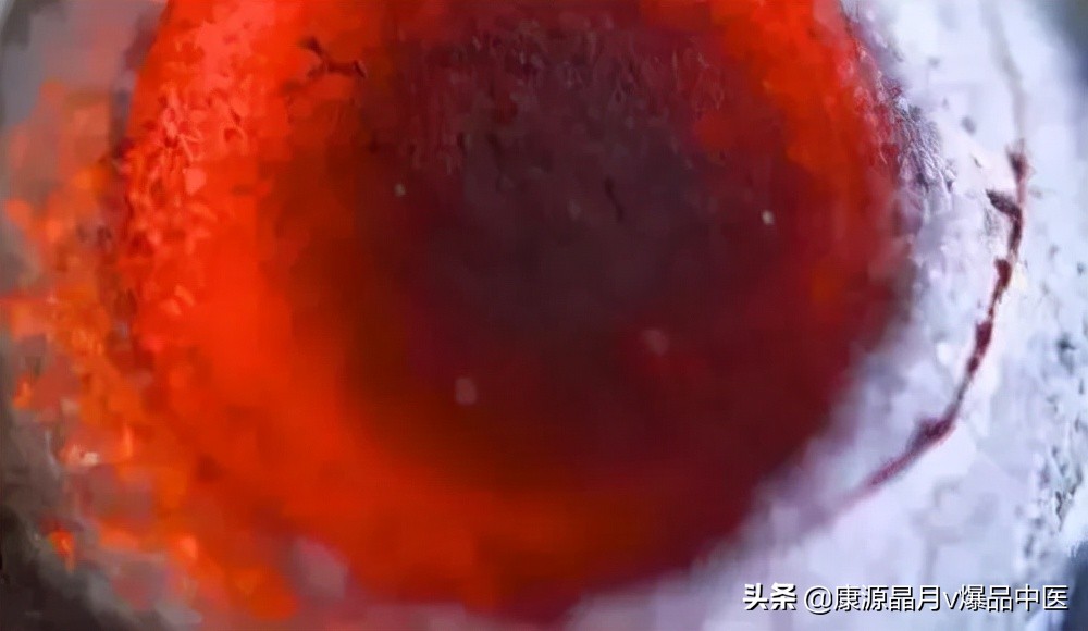 不要乱灸“神阙”，泄你的元气，减你的寿命