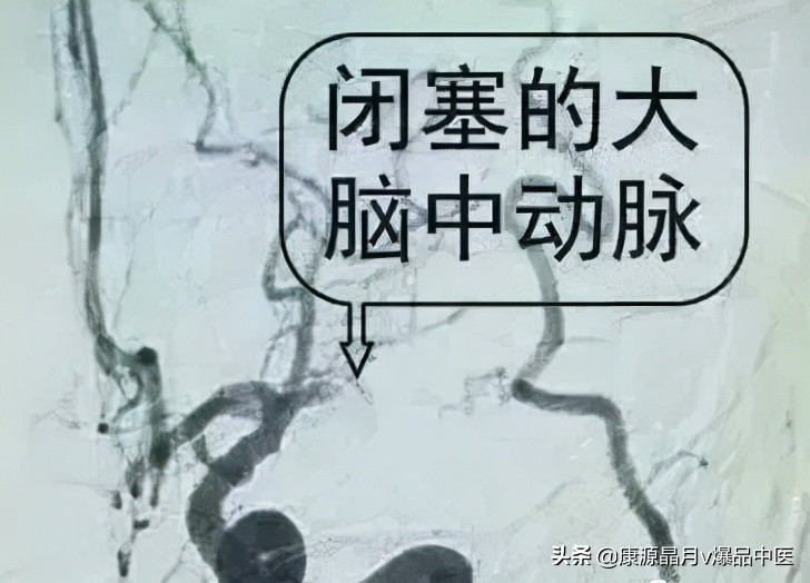 脚上有个“化血栓开关”，打开它，就可清血管、防血栓