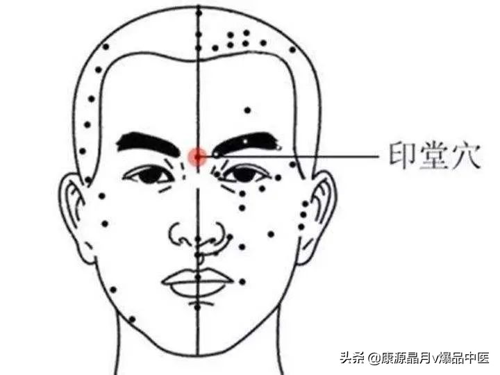 耳穴、艾灸治疗鼻炎的针灸疗法