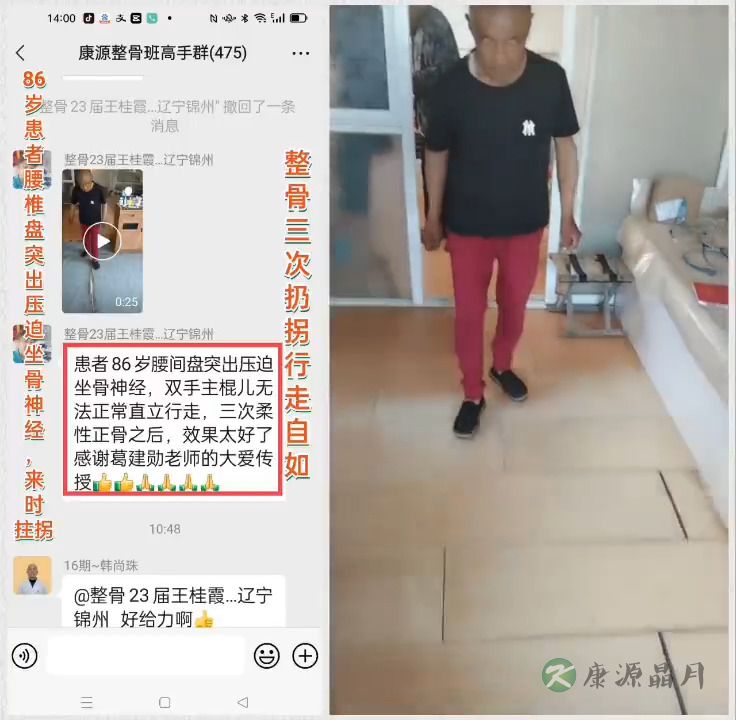 整骨三次，扔拐行走