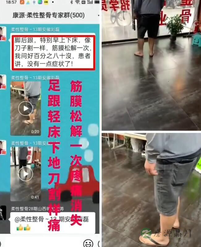 脚后跟痛：筋膜松解一次见效