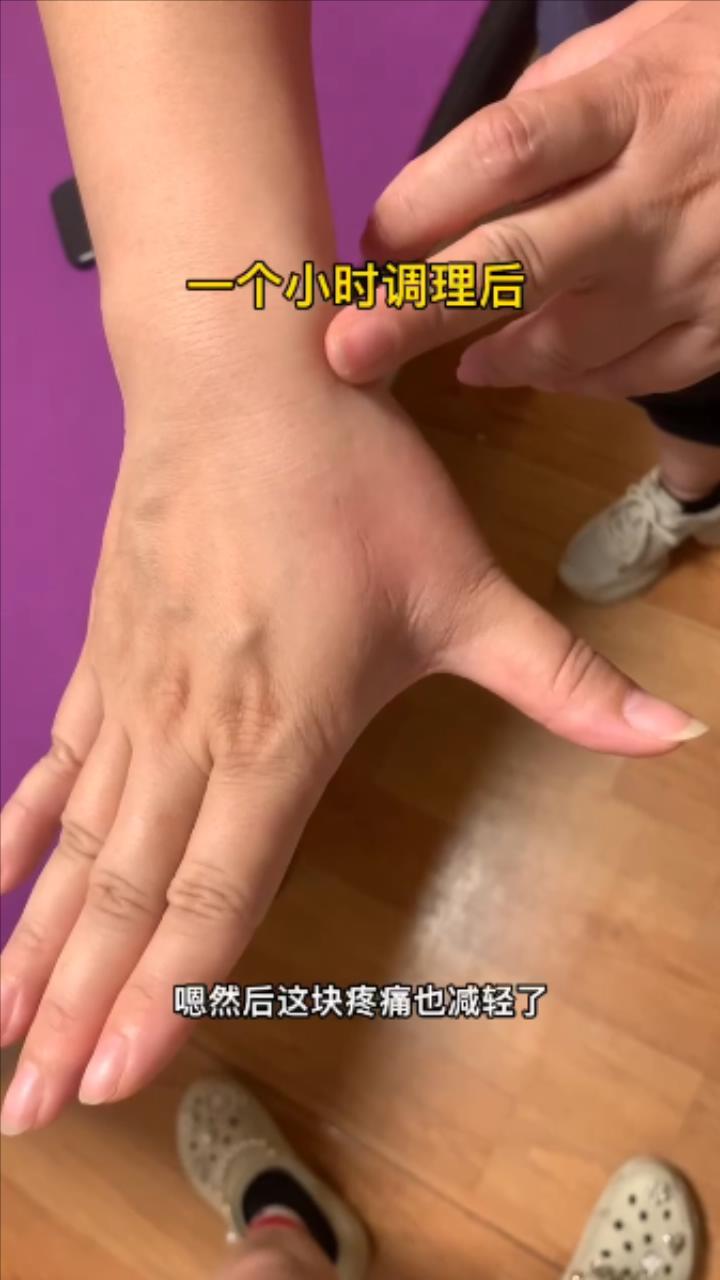 拇指功能受限，腱鞘炎案例分享