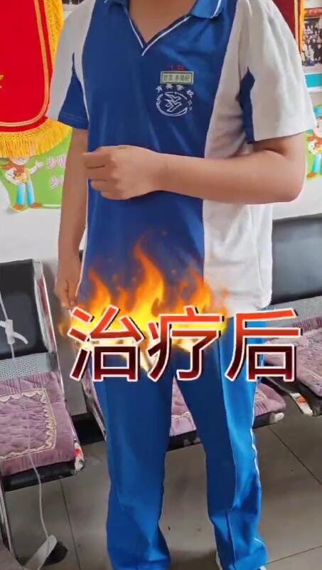 摔了一跤，胳膊疼得厉害，不能屈伸