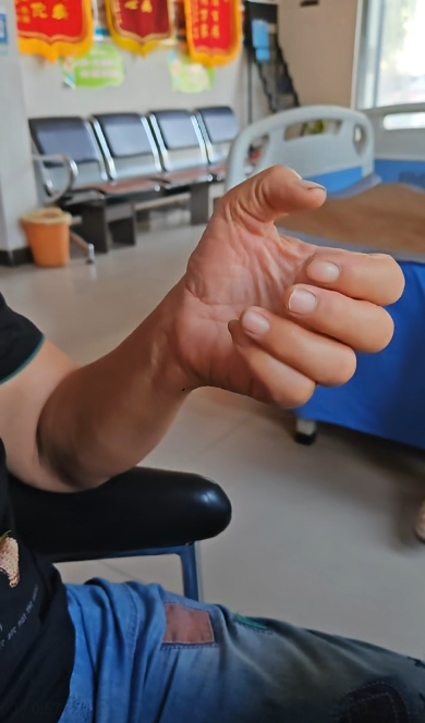 拇指腱鞘炎都能收获一面锦旗