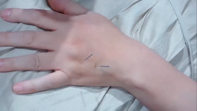 失眠上肢取穴技巧，实操首发，速看！