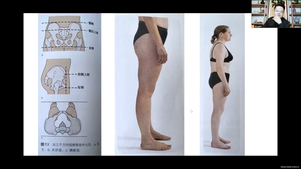 【福利】骨盆前倾与骨盆后倾评估与治疗