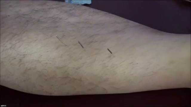 三重穴，真人演示，首次发布！