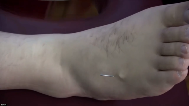 水曲穴，正确定位，首发！