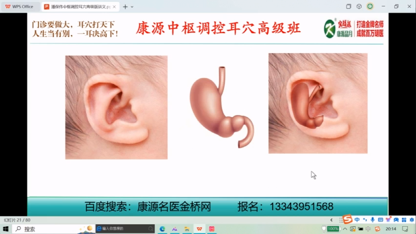 胃型耳，评估技巧，首次公开！