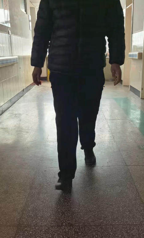 股骨头坏死，超微中药加针刀调理